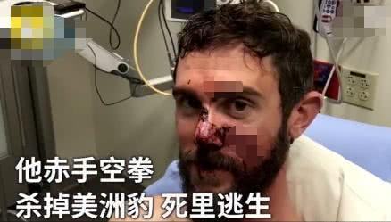 你這一胳膊肘下去,對方的頭骨都可能會被幹裂?硬核分析不容錯過 你這一胳膊肘下去,對方的頭骨都可能會被幹裂?硬核分析不容錯過