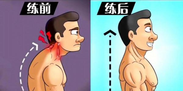脖子前傾頸部僵硬問題,閱讀一分鐘教會你頸部前傾如何改善 脖子前傾頸部僵硬問題,閱讀一分鐘教會你頸部前傾如何改善