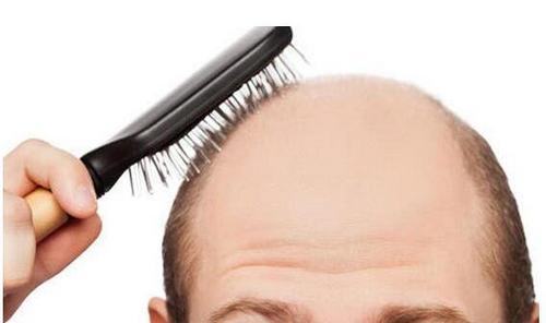 每天頭髮脫落不超過100根算正常，如何預防？