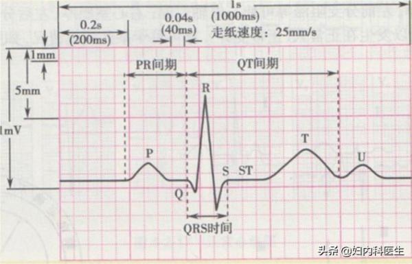 就診常見的心電圖，你會看嗎？