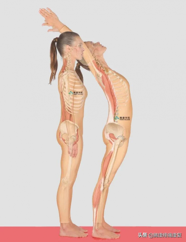 後仰腰痛的分析① 後仰腰痛的分析①