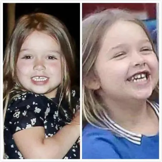 這幾個小習慣不改掉,小心娃會變醜受罪還費錢 這幾個小習慣不改掉,小心娃會變醜受罪還費錢