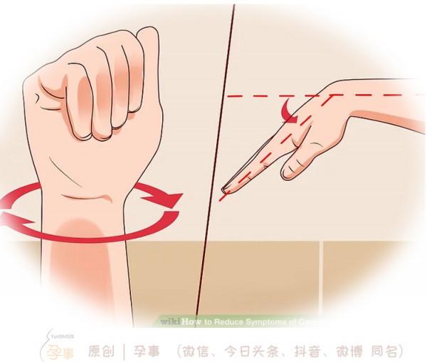 熊黛林產後10天患“媽媽手”，要遠離它其實很簡單