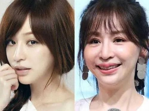 5位“毀容”的明星,胡歌“鬼門關”逃了出來,王心凌令人惋惜 5位“毀容”的明星,胡歌“鬼門關”逃了出來,王心凌令人惋惜