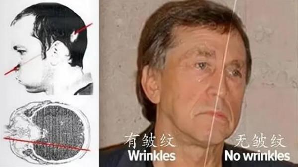 0.1奈米的一根線瞬間切割人體,可造成什麼傷害?還是沒有影響? 0.1奈米的一根線瞬間切割人體,可造成什麼傷害?還是沒有影響?