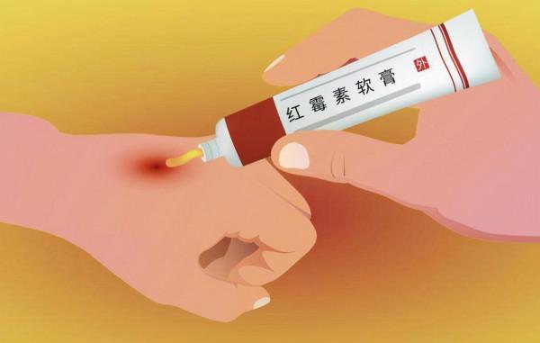 藥店裡4種便宜又好用的藥，店員或許不會主動給你拿，自己應瞭解