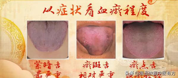 中藥止痛神方,兩味藥泡水,即可祛瘀、止痛、散結,讓你展顏開懷 中藥止痛神方,兩味藥泡水,即可祛瘀、止痛、散結,讓你展顏開懷