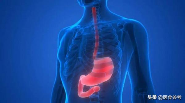 腹痛、腹脹，可能是消化性潰瘍！“三分治，七分養”調理好胃腸