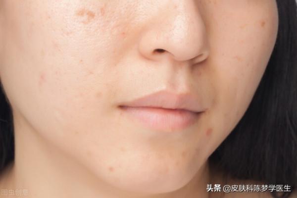 嶺南面板病流派的傳承代表人物——範瑞強教授