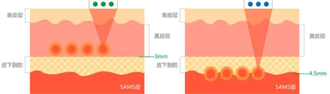 面部面板鬆弛下垂…很顯老怎麼辦？試試這個辦法