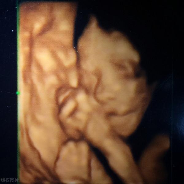 懷孕產檢可以不用全程陪，但這三個產檢專案，寶爸們請別缺席