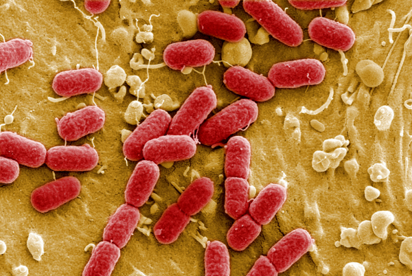 人去世後,身體48小時內會有哪些變化?為什麼比豬肉發臭得更快? 人去世後,身體48小時內會有哪些變化?為什麼比豬肉發臭得更快?