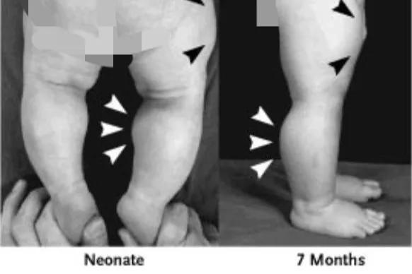 大猩猩不鍛鍊都會肌肉發達，為什麼人類就不行？是基因被壓制？