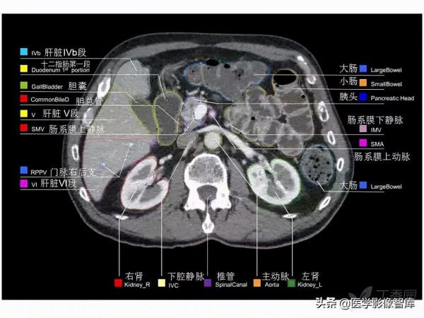 CT斷層解剖圖譜最全總結「推薦收藏」 CT斷層解剖圖譜最全總結「推薦收藏」