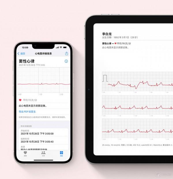 「晚報」國行 Apple Watch 支援“心電圖”/索尼 PS4 主機被破解