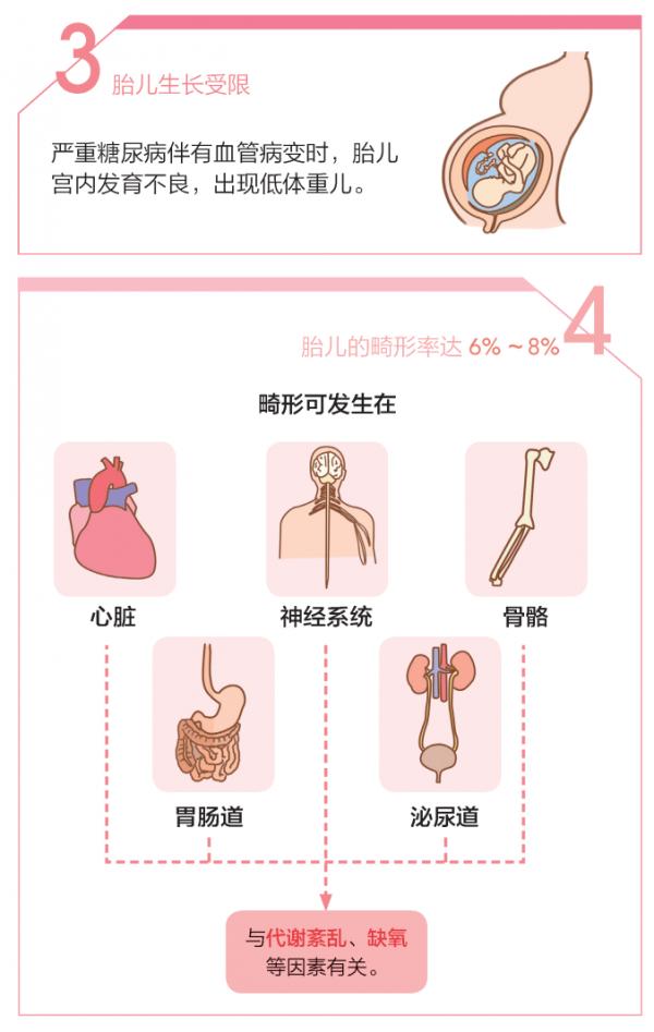 孕媽媽為何會患糖尿病?糖尿病對孕媽媽、寶寶及新生兒都存在哪些影響 孕媽媽為何會患糖尿病?糖尿病對孕媽媽、寶寶及新生兒都存在哪些影響