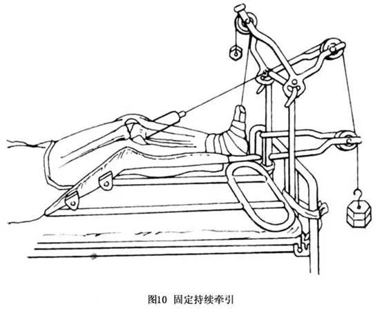 家有老人請注意，“人生最後一次骨折”，年死亡率可達50%