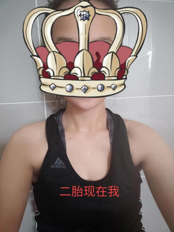 生完孩子，都瘦了，就只有肚子瘦不了！你有嗎？