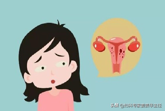 運動能治好腺肌症，這是真的嗎？