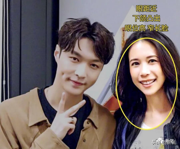 如果早知道整形天花板這件事,舒暢也不至於臉變成這樣... 如果早知道整形天花板這件事,舒暢也不至於臉變成這樣...