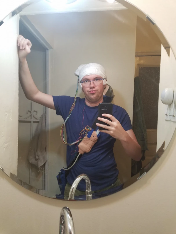 因為害怕死亡，美國小哥動手術切掉部分大腦：徹底消除恐懼感