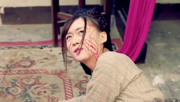 有人熱油澆臉不起泡，有人臉被燙熟創醫療奇蹟，國產劇毀容太離譜