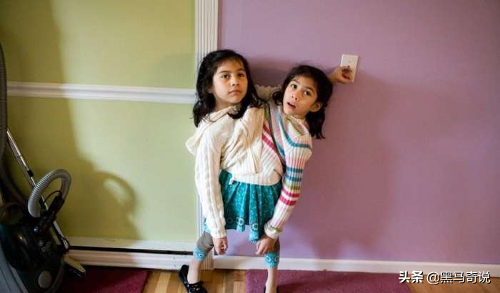 連體人的感官相通嗎，他們共用一個身體，一個死亡另一個會怎樣？