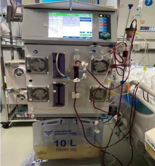 53歲阿姨一頓吃了3斤牛肉+海參燉雞,結果進了ICU 53歲阿姨一頓吃了3斤牛肉+海參燉雞,結果進了ICU