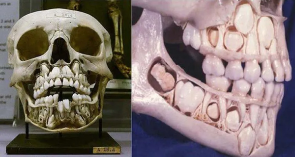 鱷魚一生能換50次牙，人卻只能換一次牙，這合理嗎？這科學嗎？