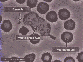 發燒了,醫生如何判斷感染源是細菌還是病毒?兩步走保證確診無誤 發燒了,醫生如何判斷感染源是細菌還是病毒?兩步走保證確診無誤
