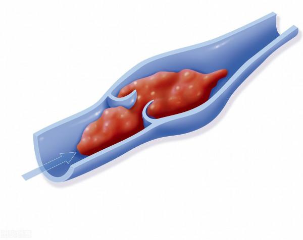 9歲男孩,剛開學就渾身無力胸部痛?醫生:罪魁禍首是躺著玩手機 9歲男孩,剛開學就渾身無力胸部痛?醫生:罪魁禍首是躺著玩手機