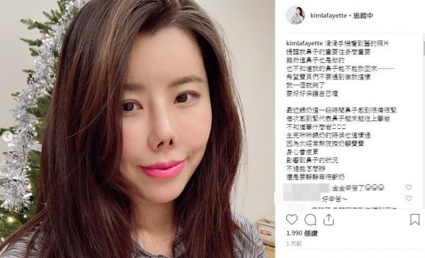 10位“整容過度”的女星：舒暢張檬畫蛇添足，黃夏惠變“鞋拔臉”