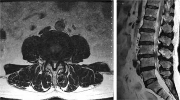 腰疼來就診，在放射科我們需要做哪些檢查？