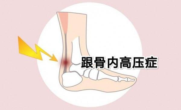 走路腳後跟疼，到底是什麼原因？醫生：帶你揪出跟痛症的真相
