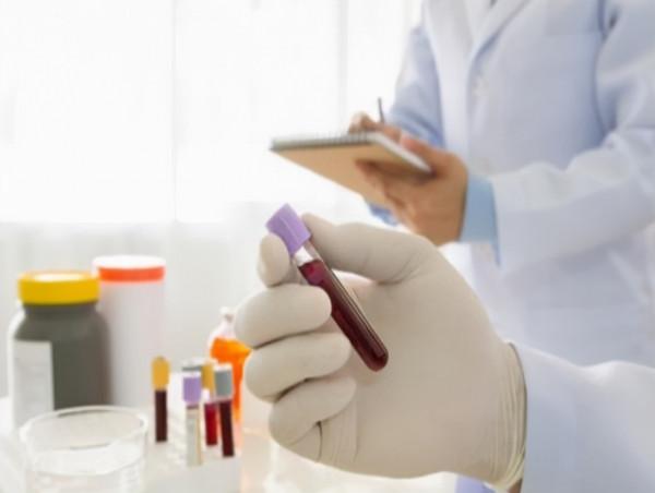 每天吃沙坦類降壓藥，注意這3點，建議瞭解