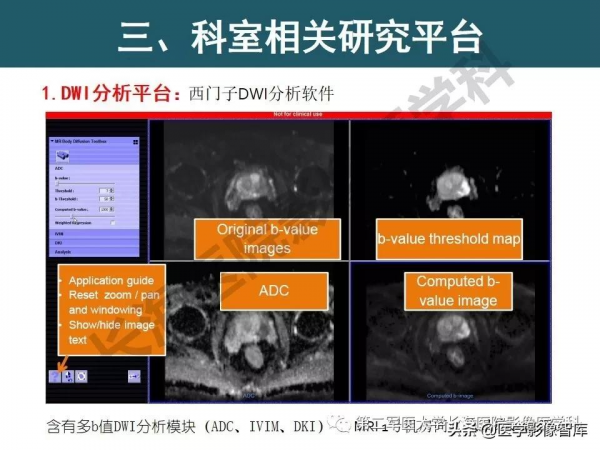 體部DWI共識及胰腺DWI研究經驗介紹