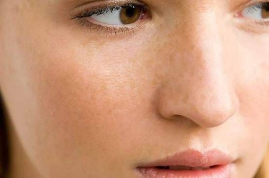 面部出現4種變化，身體可能出現問題，需謹慎