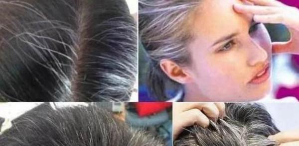 少頭白，年輕如何對抗白髮？