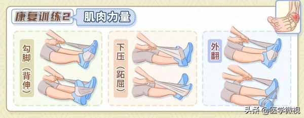 一次崴腳，次次崴腳，崴腳還容易“上癮”？