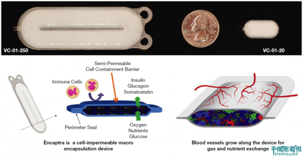 治癒糖尿病的新希望:胰島細胞封裝術 治癒糖尿病的新希望:胰島細胞封裝術