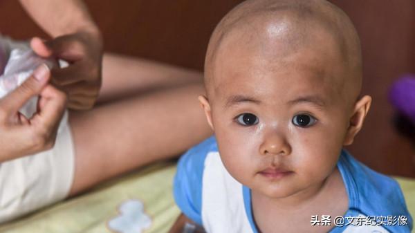 不幸面前父愛如山:“哪怕付出生命的代價,我也要救我女兒” 不幸面前父愛如山:“哪怕付出生命的代價,我也要救我女兒”