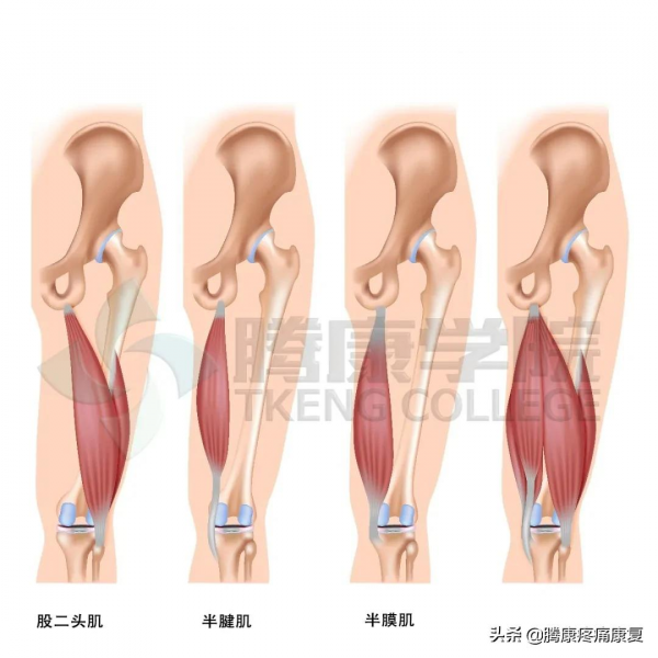 緊張的四頭肌與腰痛的關係 緊張的四頭肌與腰痛的關係