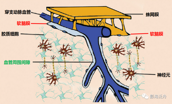 VR腔隙、腔梗灶、微出血、脫髓鞘，傻傻分不清？快看這裡