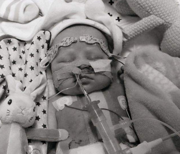 1984年,美國母親為給初生女兒續命,冒險移植狒狒心臟,最後怎樣了? 1984年,美國母親為給初生女兒續命,冒險移植狒狒心臟,最後怎樣了?