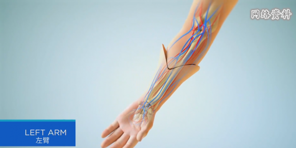 不得不承認美國醫術很強:斷了6年的雙臂,竟成功移植他人手臂 不得不承認美國醫術很強:斷了6年的雙臂,竟成功移植他人手臂