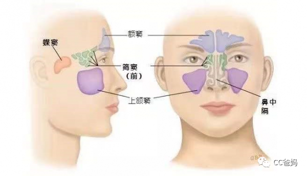 不是感冒！孩子鼻塞、流鼻涕總不見好，這幾種情況千萬別大意！