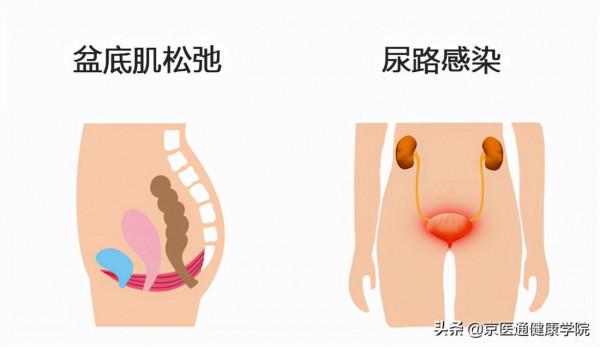 夜尿多不是小事！需警惕4種疾病