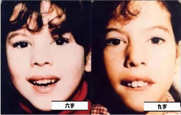 被凸嘴困擾的中國女孩，都是隱藏的大美人