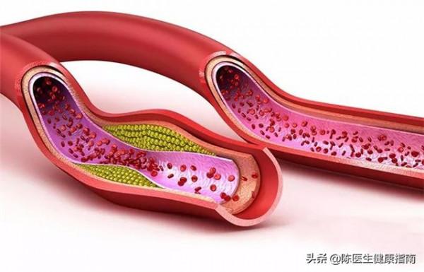 高血壓補葉酸,吃多長時間合適?同型半胱氨酸高,多長時間複查? 高血壓補葉酸,吃多長時間合適?同型半胱氨酸高,多長時間複查?