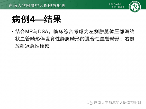 腦動靜脈畸形影像學特徵